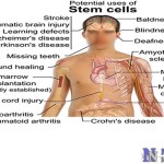 human-stem-cell-therapy